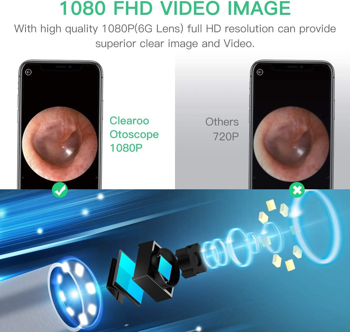 Wireless Ear Wax Removal Endoscope with 1080P FHD Camera and 6 LED Lights, Compatible with iPhone, iPad, and Android Devices (Blue)